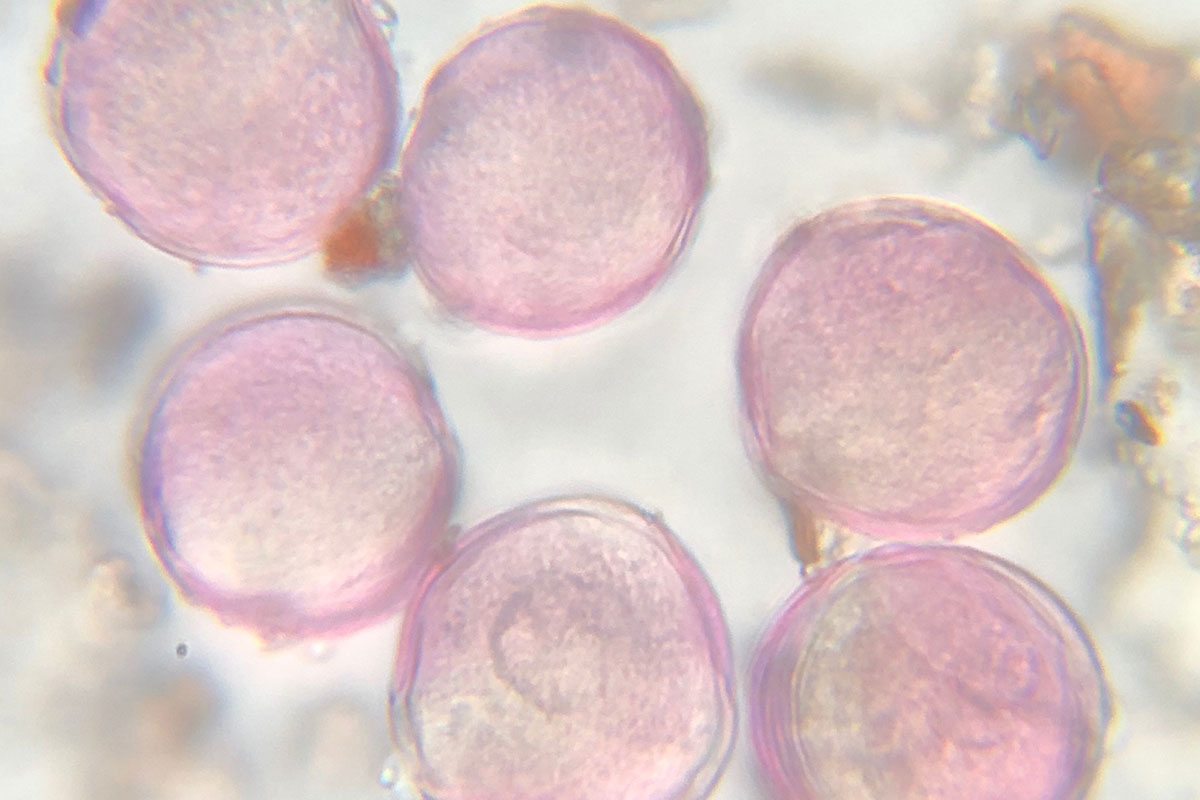 Elm Pollen Starting To Release Allergy And Asthma Center Of Western 